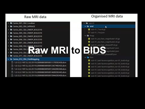 MRI to BIDS walk-through