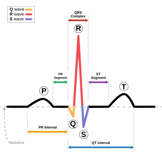 QRS